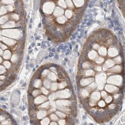 Invitrogen WIPF2 Polyclonal Antibody 100 &mu;L; Unconjugated:Antibodies,