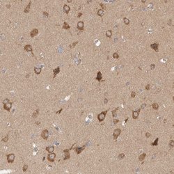 Invitrogen WIPF2 Polyclonal Antibody 100 &mu;L; Unconjugated:Antibodies,
