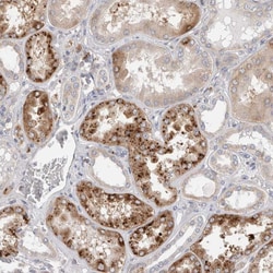 Invitrogen TBC1D16 Polyclonal Antibody 100 &mu;L; Unconjugated:Antibodies,