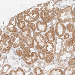 Invitrogen UNC13B Polyclonal Antibody 100 &mu;L; Unconjugated:Antibodies,