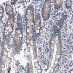 Invitrogen FAM83H Polyclonal Antibody 100 &mu;L; Unconjugated:Antibodies,