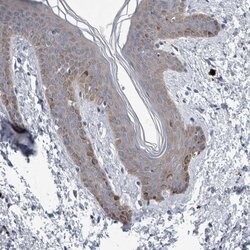 Invitrogen FAM83H Polyclonal Antibody 100 &mu;L; Unconjugated:Antibodies,