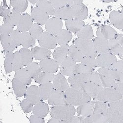 Invitrogen FAM83H Polyclonal Antibody 100 &mu;L; Unconjugated:Antibodies,