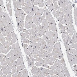Invitrogen TDRD7 Polyclonal Antibody 100 &mu;L; Unconjugated:Antibodies,
