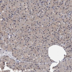 Invitrogen TDRD7 Polyclonal Antibody 100 &mu;L; Unconjugated:Antibodies,