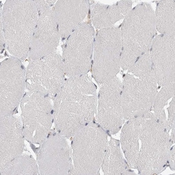 Invitrogen TDRD7 Polyclonal Antibody 100 &mu;L; Unconjugated:Antibodies,