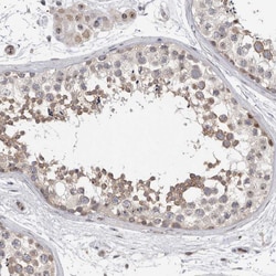 Invitrogen TDRD7 Polyclonal Antibody 100 &mu;L; Unconjugated:Antibodies,