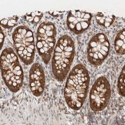 Invitrogen MRPL41 Polyclonal Antibody 100 μL; Unconjugated:Antibodies,
