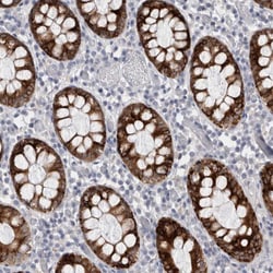 Invitrogen PWP2 Polyclonal Antibody 100 &mu;L; Unconjugated:Antibodies,
