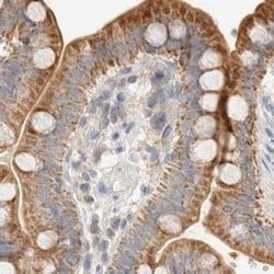 Invitrogen HDHD3 Polyclonal Antibody 100 &mu;L | Buy Online | Invitrogen&trade; | Fisher Scientific