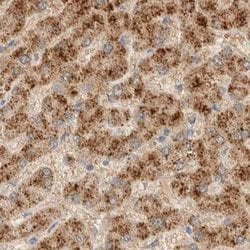 Invitrogen HDHD3 Polyclonal Antibody 100 &mu;L | Buy Online | Invitrogen&trade; | Fisher Scientific