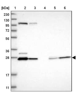 Invitrogen HDHD3 Polyclonal Antibody 100 &mu;L | Buy Online | Invitrogen&trade; | Fisher Scientific
