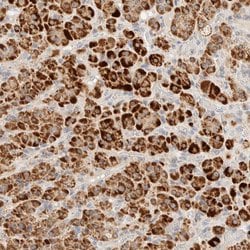 Invitrogen HDHD3 Polyclonal Antibody 100 &mu;L | Buy Online | Invitrogen&trade; | Fisher Scientific