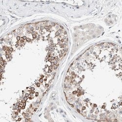 Invitrogen CASC3 Polyclonal Antibody 100 &mu;L; Unconjugated:Antibodies,
