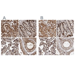 Invitrogen IARS2 Polyclonal Antibody 100 &mu;L; Unconjugated:Antibodies,