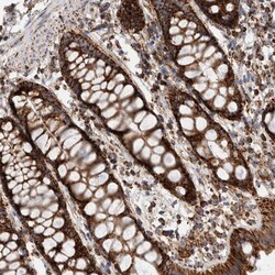 Invitrogen IARS2 Polyclonal Antibody 100 &mu;L; Unconjugated:Antibodies,