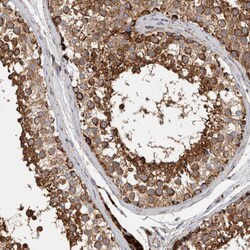 Invitrogen IARS2 Polyclonal Antibody 100 &mu;L; Unconjugated:Antibodies,