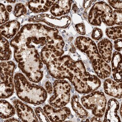 Invitrogen IARS2 Polyclonal Antibody 100 &mu;L; Unconjugated:Antibodies,