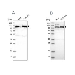 Invitrogen IARS2 Polyclonal Antibody 100 &mu;L; Unconjugated:Antibodies,