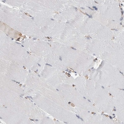 Invitrogen FAM83H Polyclonal Antibody 100 &mu;L | Buy Online | Invitrogen&trade; | Fisher Scientific