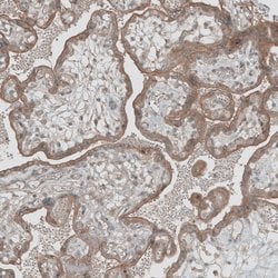 Invitrogen GREB1 Polyclonal Antibody 100 &mu;L; Unconjugated:Antibodies,