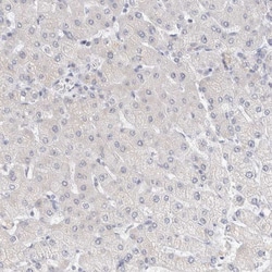 Invitrogen NEDD4L Polyclonal Antibody 100 &mu;L; Unconjugated:Antibodies,