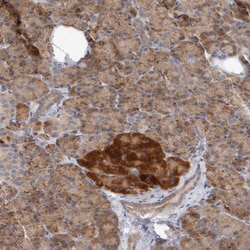 Invitrogen NEDD4L Polyclonal Antibody 100 &mu;L; Unconjugated:Antibodies,