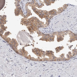 Invitrogen NEDD4L Polyclonal Antibody 100 &mu;L; Unconjugated:Antibodies,