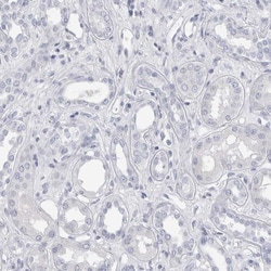 Invitrogen ADAM2 Polyclonal Antibody 100 &mu;L; Unconjugated:Antibodies,
