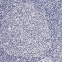 Invitrogen ADAM2 Polyclonal Antibody 100 &mu;L; Unconjugated:Antibodies,