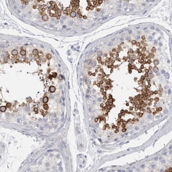 Invitrogen ADAM2 Polyclonal Antibody 100 &mu;L; Unconjugated:Antibodies,