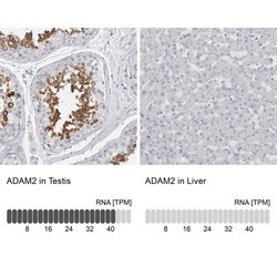 Invitrogen ADAM2 Polyclonal Antibody 100 &mu;L; Unconjugated:Antibodies,