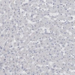 Invitrogen ADAM2 Polyclonal Antibody 100 &mu;L; Unconjugated:Antibodies,