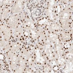 Invitrogen ZNF768 Polyclonal Antibody 100 &mu;L; Unconjugated:Antibodies,