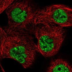 Invitrogen TRBP1 Polyclonal Antibody 100 &mu;L; Unconjugated:Antibodies,