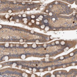 Invitrogen TRBP1 Polyclonal Antibody 100 &mu;L; Unconjugated:Antibodies,