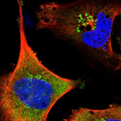 SAMD12 Polyclonal Antibody