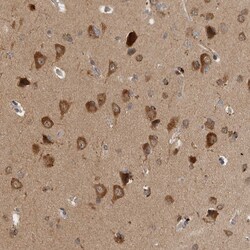 SAMD12 Polyclonal Antibody
