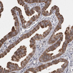 SAMD12 Polyclonal Antibody
