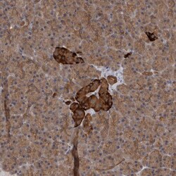 SAMD12 Polyclonal Antibody
