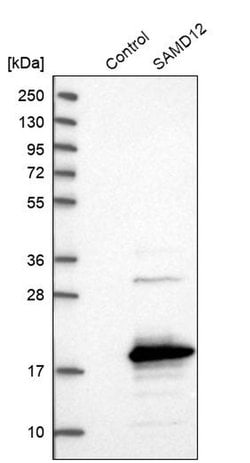 SAMD12 Polyclonal Antibody