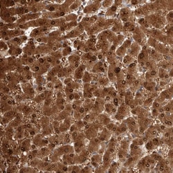 Invitrogen PGM1 Polyclonal Antibody 100 &mu;L | Buy Online | Invitrogen&trade; | Fisher Scientific