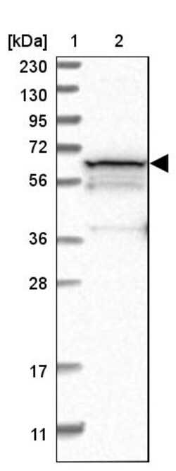 Invitrogen PGM1 Polyclonal Antibody 100 &mu;L | Buy Online | Invitrogen&trade; | Fisher Scientific