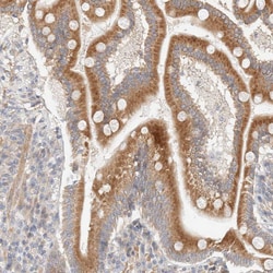 Invitrogen RRP15 Polyclonal Antibody 100 &mu;L; Unconjugated:Antibodies,