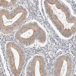 Invitrogen RRP15 Polyclonal Antibody 100 &mu;L; Unconjugated:Antibodies,