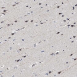 Invitrogen ARHGEF10 Polyclonal Antibody 100 &mu;L | Buy Online | Invitrogen&trade; | Fisher Scientific