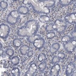 Invitrogen ARHGEF10 Polyclonal Antibody 100 &mu;L | Buy Online | Invitrogen&trade; | Fisher Scientific