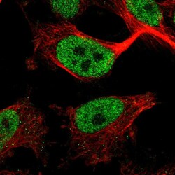 Invitrogen ZNF295 Polyclonal Antibody 100 &mu;L; Unconjugated:Antibodies,