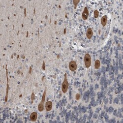 Invitrogen ZNF295 Polyclonal Antibody 100 &mu;L; Unconjugated:Antibodies,