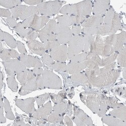 Invitrogen ZNF295 Polyclonal Antibody 100 &mu;L; Unconjugated:Antibodies,